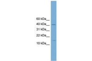 Image no. 1 for anti-Pre-B-Cell Leukemia Homeobox 4 (PBX4) (N-Term) antibody (ABIN6744610) (PBX4 anticorps  (N-Term))