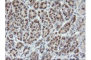 anti-Src-like-adaptor 2 (SLA2) antibody