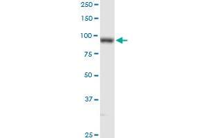 PLOD2 MaxPab rabbit polyclonal antibody. (PLOD2 anticorps  (AA 1-758))