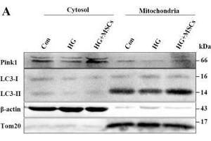 MSCs mitigate HG-induced inhibition of mitophagy through up-regulation of Pink1. (beta Actin anticorps  (AA 1-375))