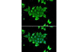 Immunofluorescence analysis of U2OS cell using PHPT1 antibody.
