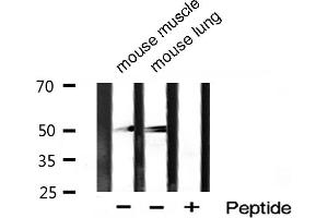 Western blot analysis of Desmin expression in various sample. (Desmin anticorps)