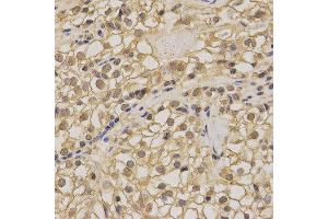 Immunohistochemistry (IHC) image for anti-Non-Metastatic Cells 1, Protein (NM23A) Expressed in (NME1) (C-Term) antibody (ABIN3020815) (NME1 anticorps  (C-Term))