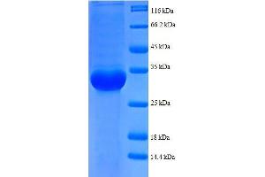 50S Ribosomal Protein L35 (AA 7-64), (partial) protein (GST tag)