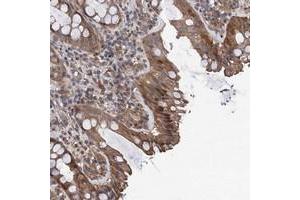 Immunohistochemical staining of human rectum with TMEM39B polyclonal antibody  shows moderate cytoplasmic and nuclear positivity in glandular cells at 1:20-1:50 dilution.
