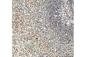 IHC analysis of SFPQ using anti-SFPQ antibody (ABIN7603089). (SFPQ anticorps  (Middle Region))