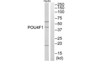 Western blot analysis of extracts from HuvEc cells, using POU4F1 antibody. (POU4F1 anticorps  (Internal Region))