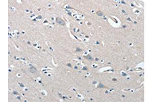 The image on the left is immunohistochemistry of paraffin-embedded Human brain tissue using ABIN7192019(PRKX Antibody) at dilution 1/15, on the right is treated with synthetic peptide. (PRKX anticorps)