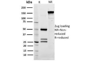 SDS-PAGE Analysis Purified CD79a Mouse Monoclonal Antibody (ZL7-4).