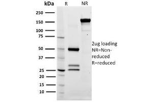 SDS-PAGE Analysis Purified CD79a Mouse Monoclonal Antibody (ZL7-4). (CD79a anticorps)