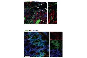 Detection of colonic tight junction proteins and heat shock proteins (HSPs) in response to Limosilactobacillus reuteri in healthy young mice.