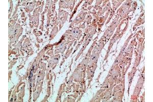 Immunohistochemical analysis of paraffin-embedded Human-heart, antibody was diluted at 1:100 (MIA anticorps  (AA 90-131))