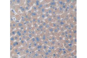 Used in DAB staining on fromalin fixed paraffin- embedded Kidney tissue