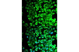 Immunofluorescence (IF) image for anti-thromboxane A Synthase 1 (Platelet) (TBXAS1) antibody (ABIN1875427) (TBXAS1 anticorps)