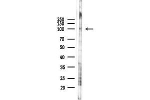 anti-Enhancer of Polycomb Homolog 1 (EPC1) antibody