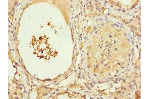 Immunohistochemistry of paraffin-embedded human testis tissue using ABIN7151076 at dilution of 1:100 (MYLIP anticorps  (AA 266-445))