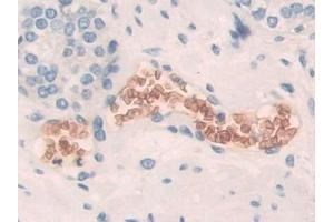 Detection of BND3 in Human Prostate Tissue using Polyclonal Antibody to Band 3 (BND3)