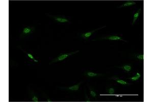 Immunofluorescence of monoclonal antibody to RAX on HeLa cell. (RAX anticorps  (AA 253-346))