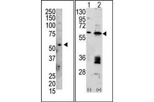 Image no. 1 for anti-Mdm2, p53 E3 Ubiquitin Protein Ligase Homolog (Mouse) (MDM2) (C-Term) antibody (ABIN356777) (MDM2 anticorps  (C-Term))