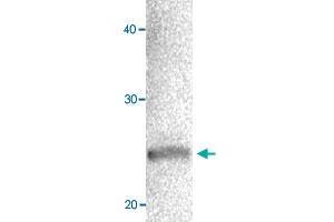 Western blot of MCF-7 cell extracts with CBX1 polyclonal antibody  at 1000 fold dilution. (CBX1 anticorps  (AA 176-185))