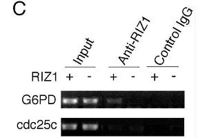 ChIP analysis of estrogen target genes. (PRDM2 anticorps  (AA 1-347))