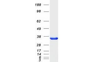 Validation with Western Blot