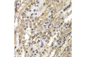 Immunohistochemistry of paraffin-embedded rat kidney using NEDD9 antibody. (NEDD9 anticorps)