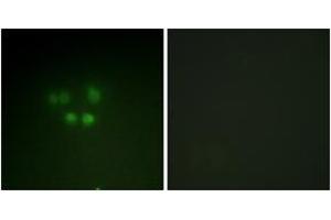 Immunofluorescence analysis of A549 cells, using Nibrin (Ab-278) Antibody. (Nibrin anticorps  (AA 251-300))
