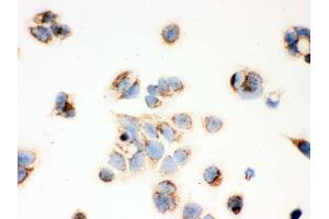 IHC analysis of ERAB using anti-ERAB antibody .