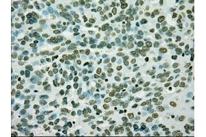 Immunohistochemistry (IHC) image for anti-Premelanosome Protein (PMEL) antibody (ABIN1500300)