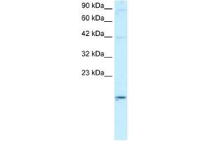 ApoBEC3G antibody used at 2 ug/ml to detect target protein. (APOBEC3G anticorps  (N-Term))