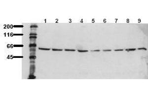 Western Blotting (WB) image for anti-V-Akt Murine Thymoma Viral Oncogene Homolog 1 (AKT1) (C-Term), (Ser473) antibody (ABIN126854) (AKT1 anticorps  (C-Term, Ser473))