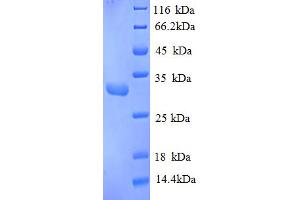 SDS-PAGE (SDS) image for Replication Protein A4, 30kDa (RPA4) (AA 1-260), (partial) protein (His tag) (ABIN5713010)