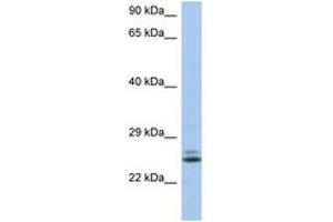 Image no. 1 for anti-RAB15, Member RAS Onocogene Family (RAB15) (AA 35-84) antibody (ABIN6743923)