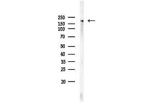 Western blot analysis of lysates from EC304 cells, using Phospho-EGFR (Tyr1173)[Tyr1197] Antibody at 1/1000 dilution.