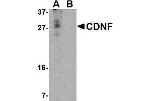 Western Blotting (WB) image for anti-Cerebral Dopamine Neurotrophic Factor (CDNF) (N-Term) antibody (ABIN1031315) (CDNF anticorps  (N-Term))
