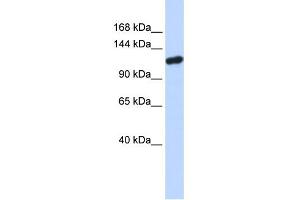 WB Suggested Anti-PIWIL4 Antibody Titration: 0. (PIWIL4 anticorps  (N-Term))