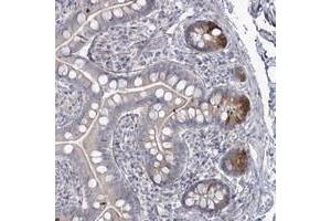 Immunohistochemical staining of human small intestine with ZC3H6 polyclonal antibody  shows distinct cytoplasmic positivity in paneth cells at 1:200-1:500 dilution. (ZC3H6 anticorps)