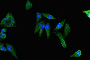 Immunofluorescent analysis of Hela cells using ABIN7143140 at dilution of 1:100 and Alexa Fluor 488-congugated AffiniPure Goat Anti-Rabbit IgG(H+L) (Actin, gamma 1 anticorps  (AA 13-166))
