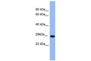 WB Suggested Anti-RAB1A Antibody Titration: 0. (RAB1A anticorps  (Middle Region))