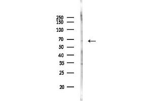 anti-Bardet-Biedl Syndrome 7 (BBS7) (Internal Region) antibody