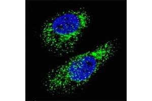 Fluorescent image of Chloroquine treated U251 cells (50 uM, 16h) stained with LC3A antibody. (MAP1LC3A anticorps  (AA 91-117))