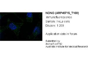 Image no. 2 for anti-Non-POU Domain Containing, Octamer-Binding (NONO) (N-Term) antibody (ABIN184023) (NONO anticorps  (N-Term))