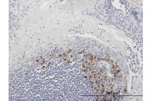 anti-Fas Apoptotic Inhibitory Molecule 3 (FAIM3) (AA 1-390) antibody