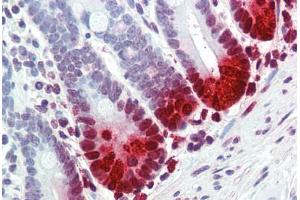 Human Small Intestine (formalin-fixed, paraffin-embedded) stained with DEFA5 antibody ABIN396940 at 10 ug/ml followed by biotinylated anti-mouse IgG secondary antibody ABIN481714, alkaline phosphatase-streptavidin and chromogen. (DEFA5 anticorps)
