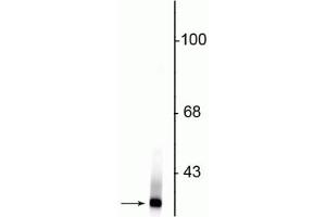 Western blot of rat kidney lysate showing specific immunolabeling of the ~21 kDa Park7 protein. (PARK7/DJ1 anticorps)