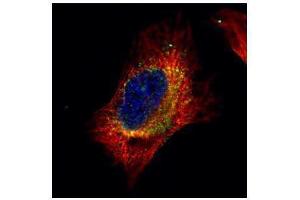 ICC/IF Image Confocal immunofluorescence analysis (Olympus FV10i) of paraformaldehyde-fixed HeLa, using Cofilin 2 (muscle), antibody (Green) at 1:500 dilution. (Cofilin 2 anticorps)