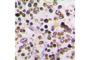 Immunohistochemical analysis of Cyclin A1 staining in human testis formalin fixed paraffin embedded tissue section.