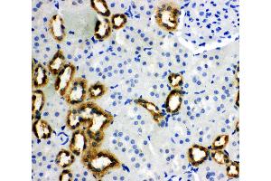 Anti-PBP antibody, IHC(P) IHC(P): Rat Kidney Tissue