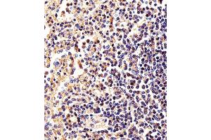 Immunohistochemical analysis of paraffin-embedded H. (beta Actin anticorps)